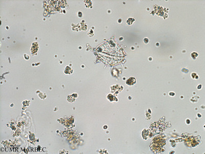 phyto/Bizerte/bizerte_bay/RISCO February 2015/Protoperidinium quinquecorne (ancien Baie_T1-A_Proto quinquecorne-2).tif(copy)_thumb.jpg